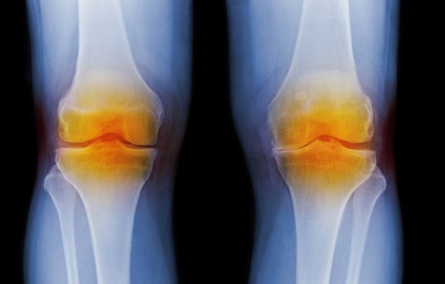 Image result for घुटना क्षतिग्रस्त